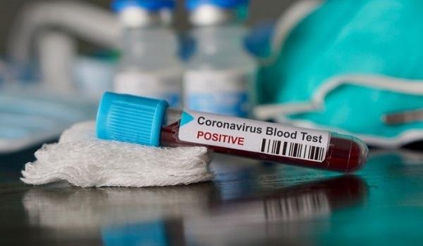 Ministério da Saúde confirma mais três casos de coronavírus no Brasil; paciente no DF tem quadro grave