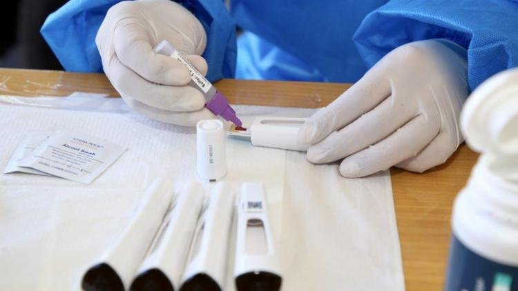 Saúde vai incinerar testes, remédios e vacinas vencidos que custaram R$ 80 milhões