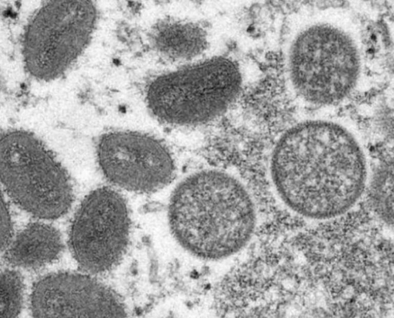 OMS declara emergência de saúde global para varíola dos macacos