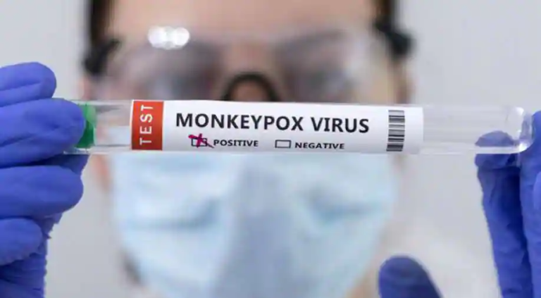 Salvador tem primeiro caso infantil de varíola dos macacos