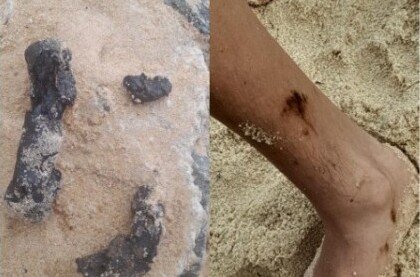 Manchas de óleo voltam a aparecer em praias de Mata de São João